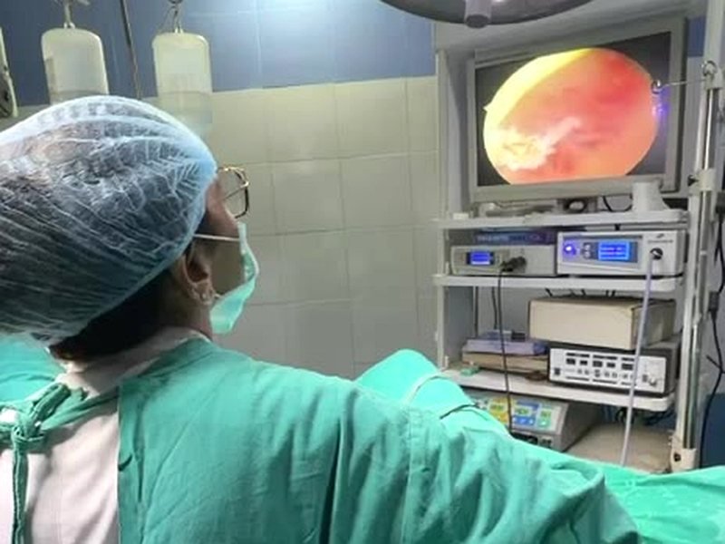 Operation Theatre